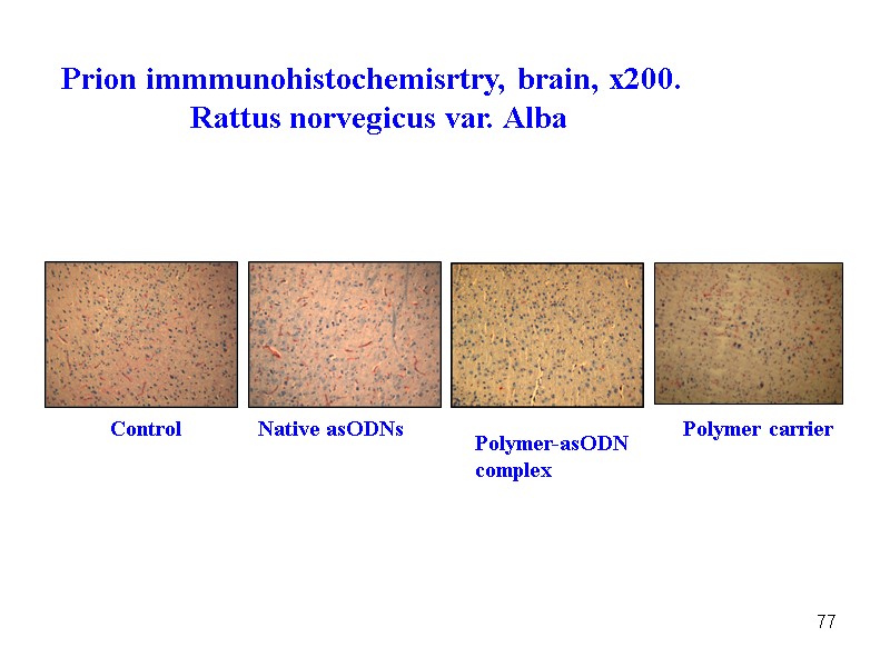 77 Control Native asODNs Polymer-asODN  complex Polymer carrier Prion immmunohistochemisrtry, brain, x200. 